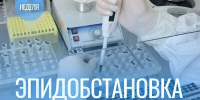 На 1 неделе 2025 года отмечено прогнозируемое снижение заболеваемости респираторными инфекциями. - Роспотребнадзор
